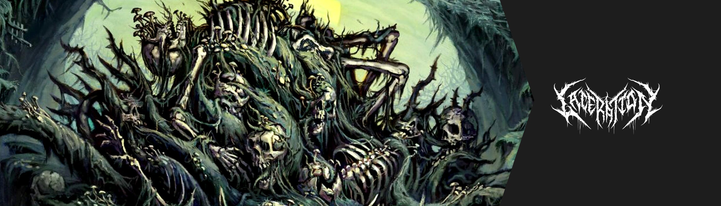 Laceration